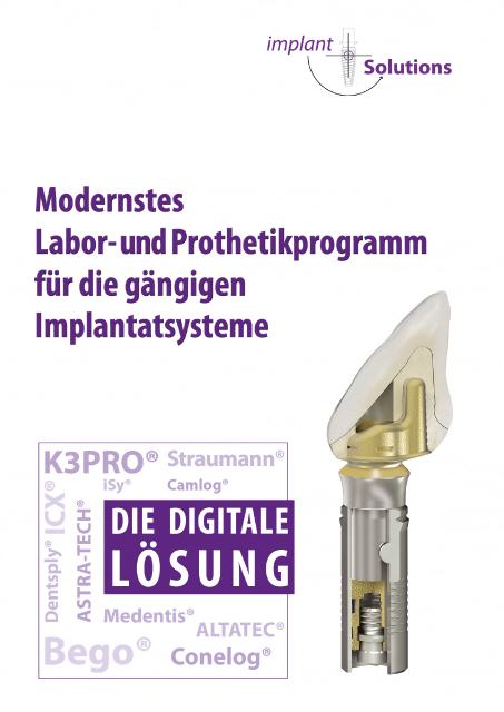 Digitale Lösung für alle gängigen Implantatsysteme